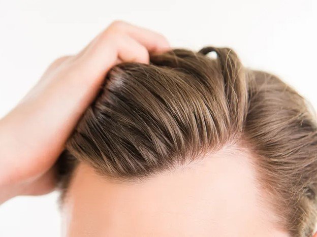 عوارض کاشت مو کوتاه مدت و بلند مدت