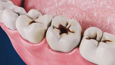 پیشگیری از بیماری های دهان و دندان