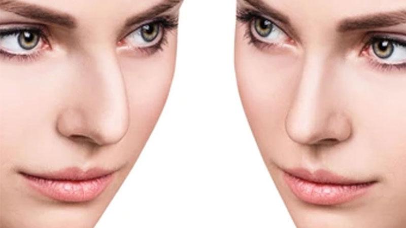 آیا سن در طبیعی بودن بینی تاثیر دارد؟